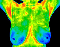 mary-tingaud-thermography.jpg
