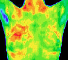 sb-breast-thermography-scan.jpg
